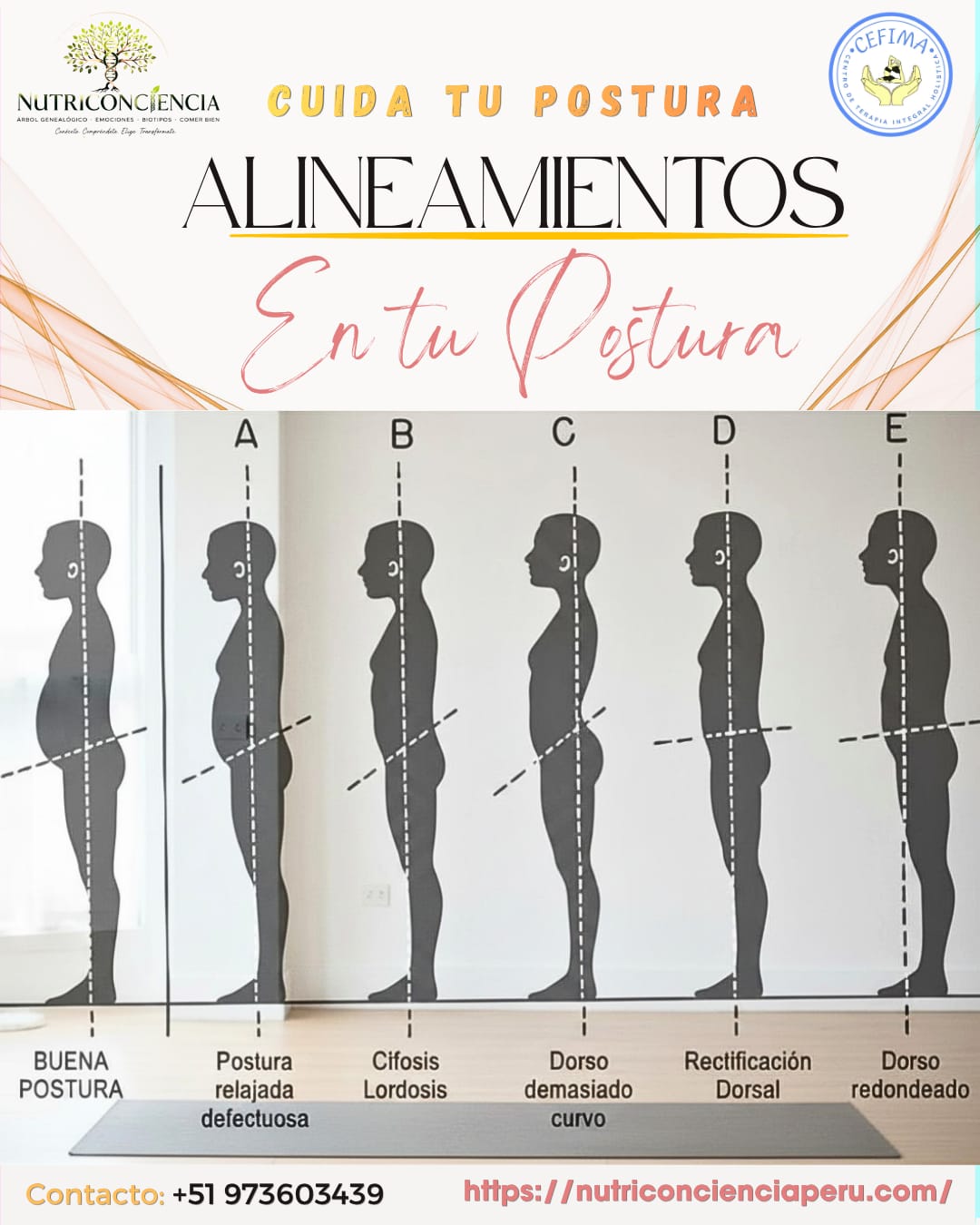 Postura y dolor crónico